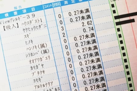 アレルギーの検査 血液検査