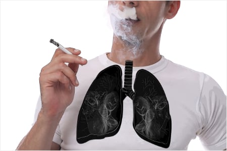 COPDの原因